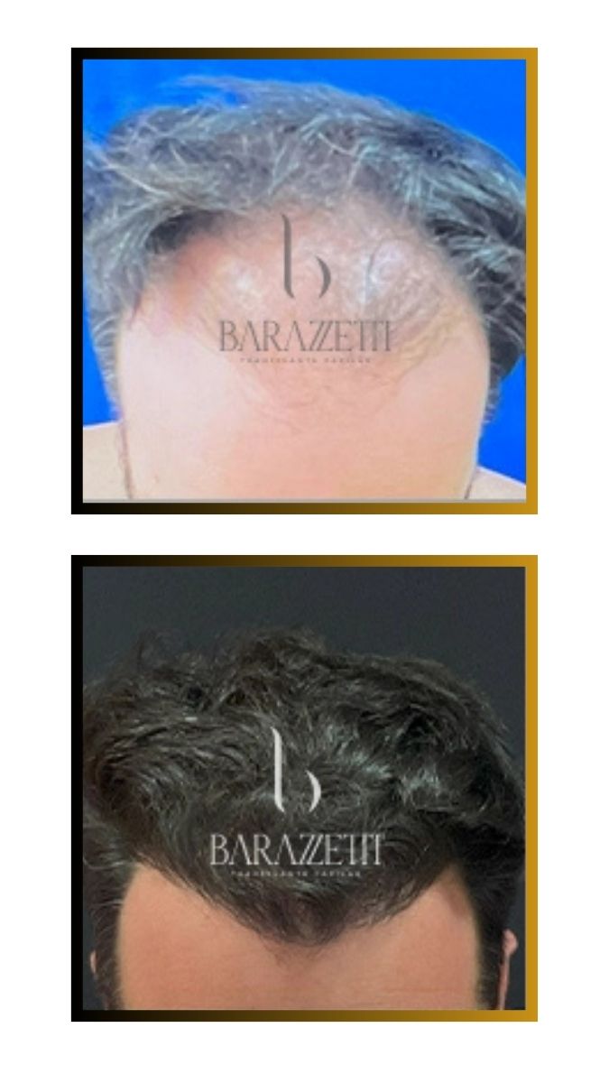 Antes e depois (2)