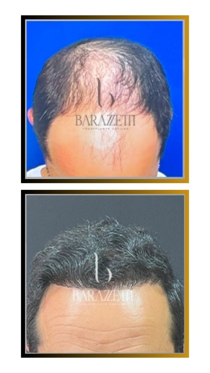 Antes e depois (3)