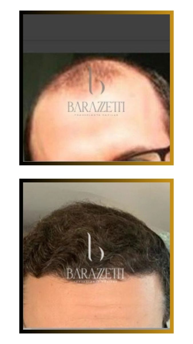 Antes e depois (4)