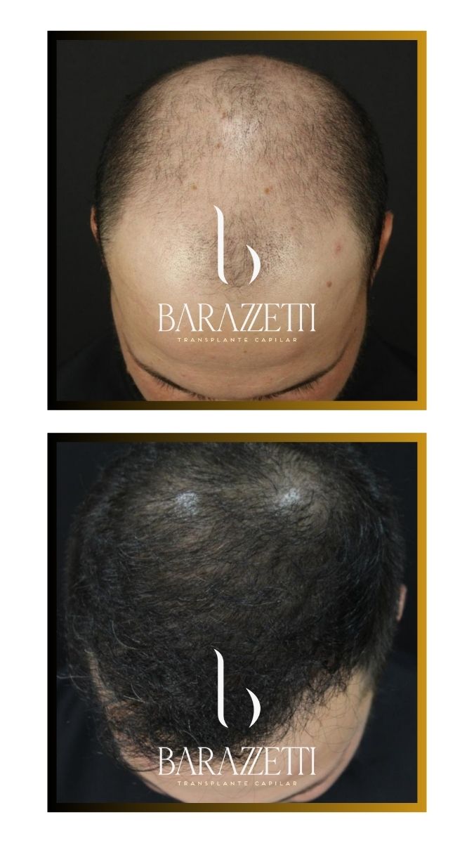 Antes e depois (5)