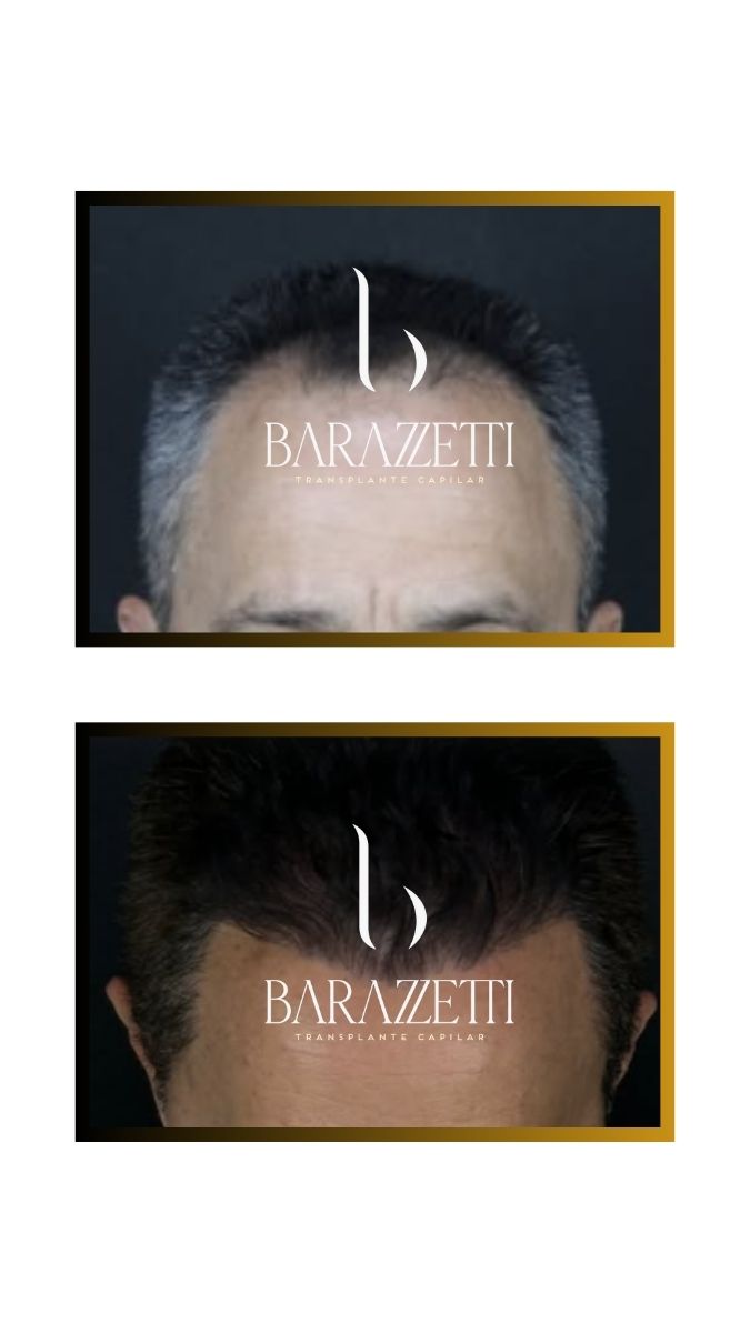 Antes e depois (7)